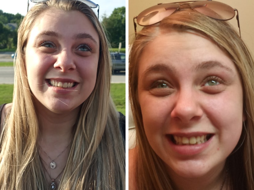 Kaylee Muthart Who Tore Out Her Own Eyeballs While High On Meth Gets Prosthetic Replacements
