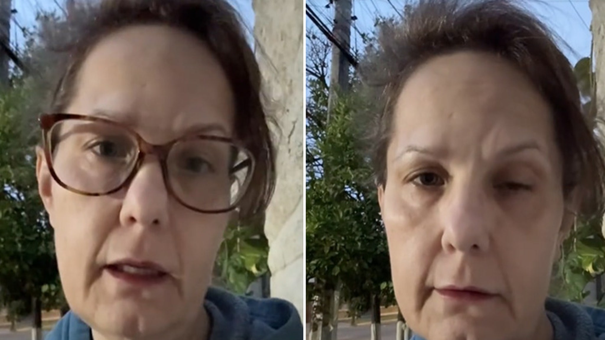 Fans In Disbelief After 50-Year-Old TikToker Shares Facelift Before and After