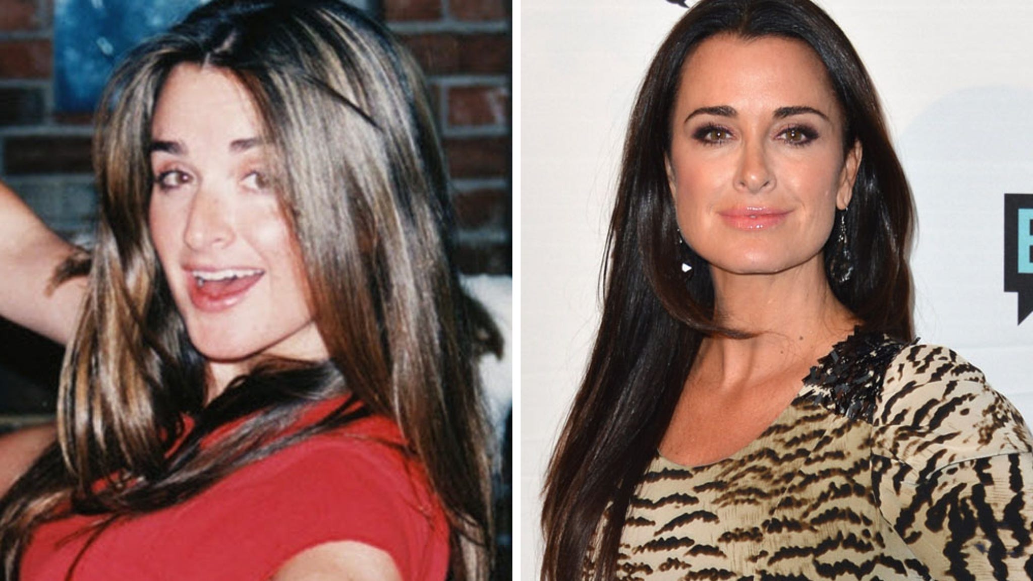 'Real Housewives' Cosmetic Surgery Confessions