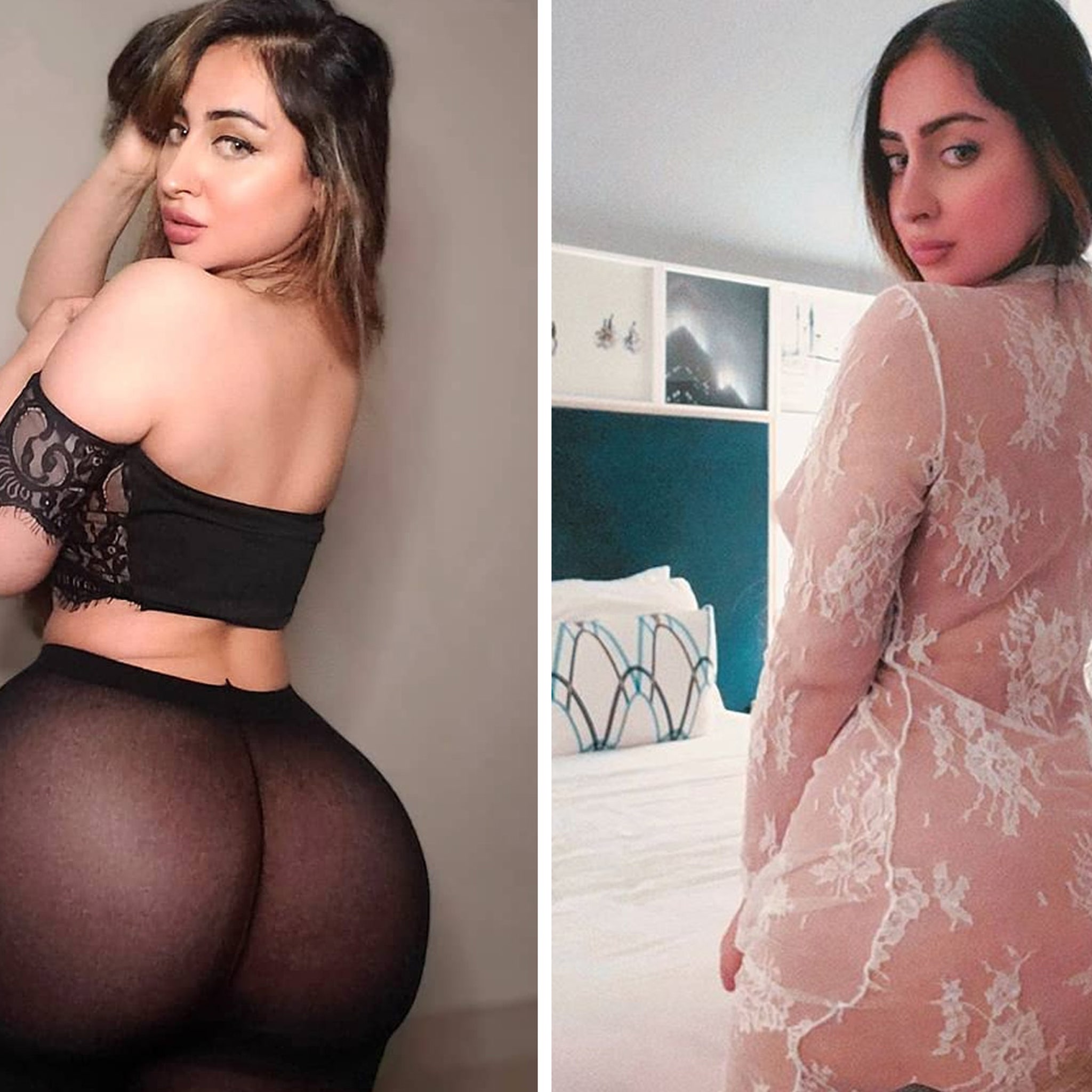 Instagram Model Says Botched Butt Lift Made Her Unable to Sit For 6 Months