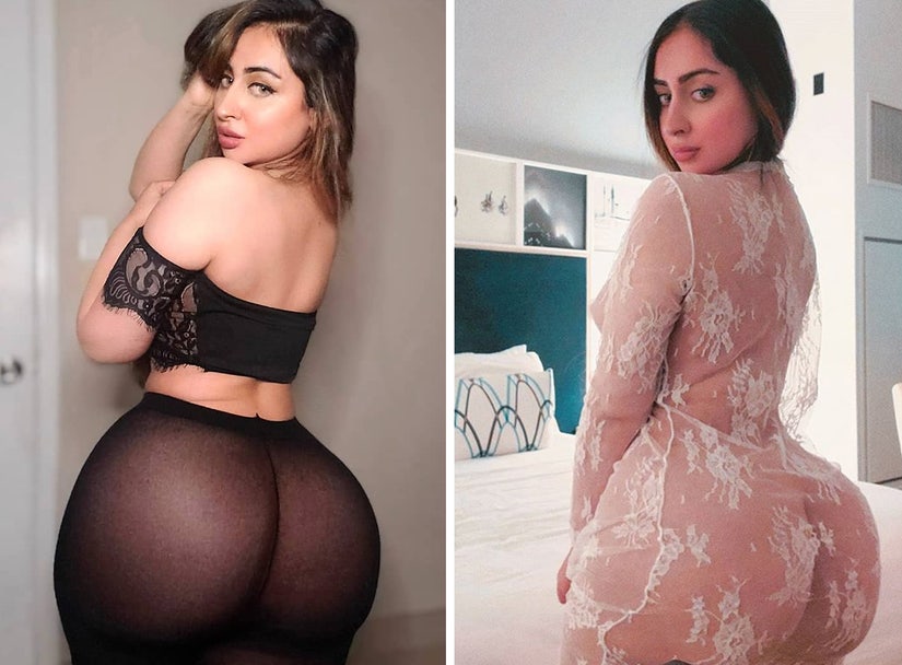 Instagram Model Says Botched Butt Lift Made Her Unable To Sit For