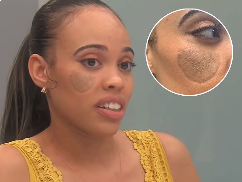 Botched Preview: Dog Bite Victim Has Pubic Hair Growing Out of Her Face
