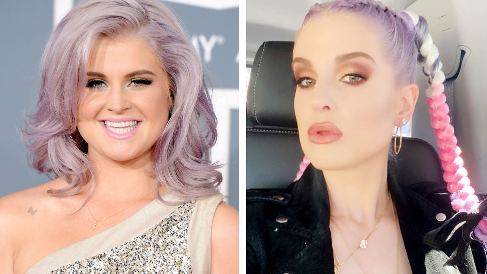 Kelly Osbourne Reveals She Had Surgery Prior To 85lb Weight Loss