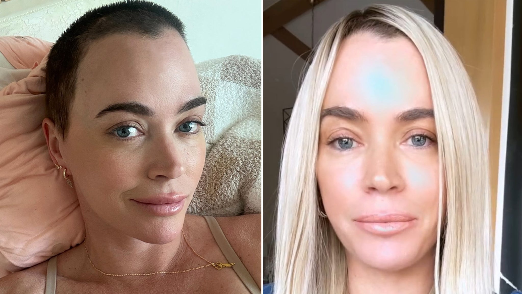 Teddi Mellencampは、脳で見られる腫瘍と肺に2つの腫瘍を明らかにします：「私はこの戦いに勝ちます」