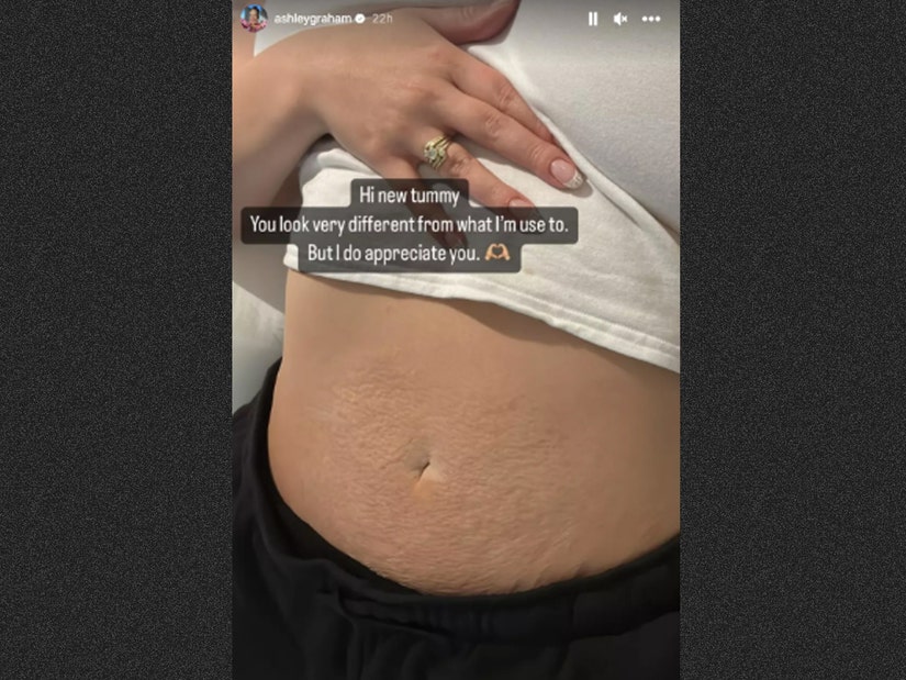 Ashley Graham Is Appreciative of Her 'New Tummy' 10 Months Postpartum