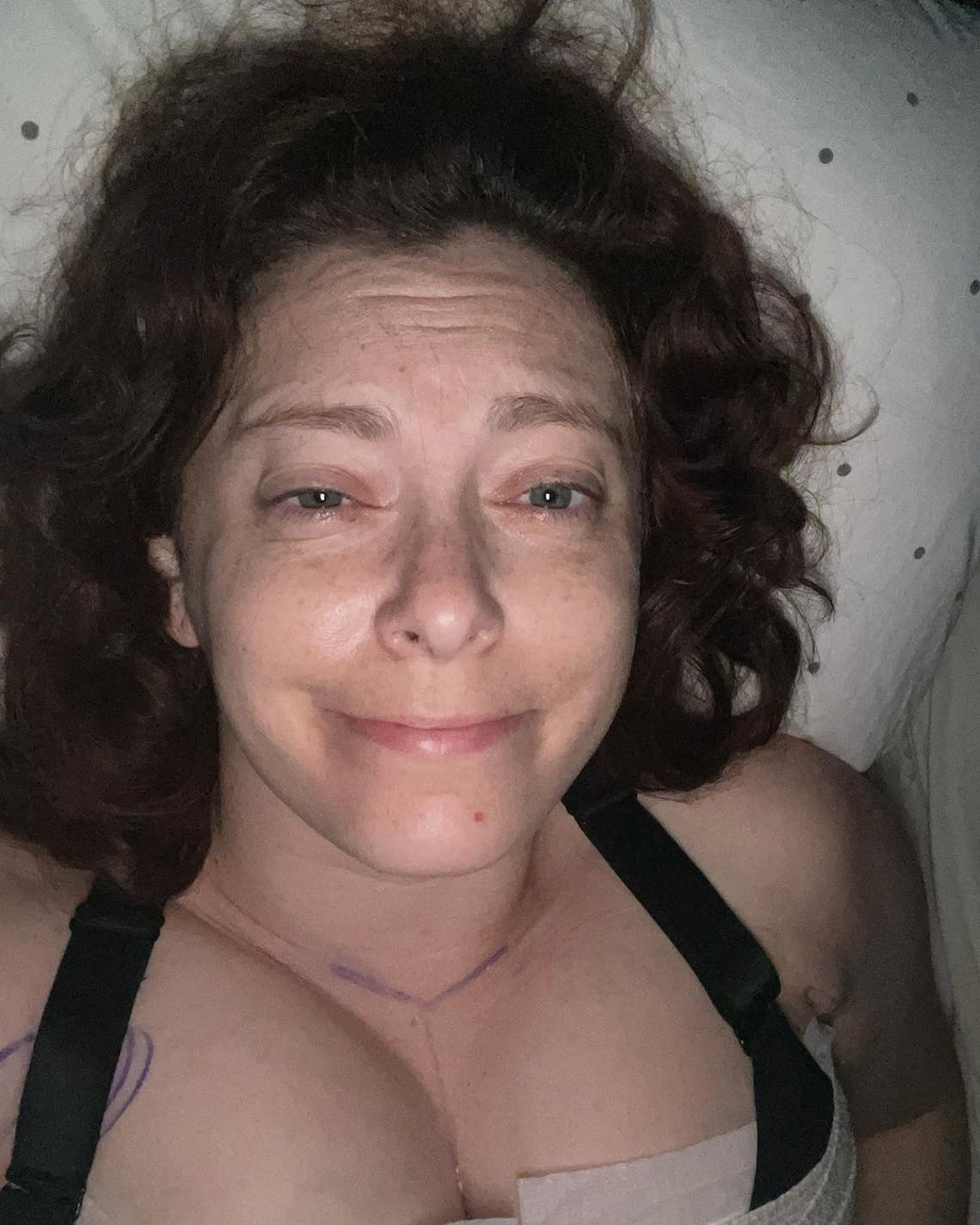 Leah McSweeney Shares Unedited 'Paper' Picture of Boob Scar