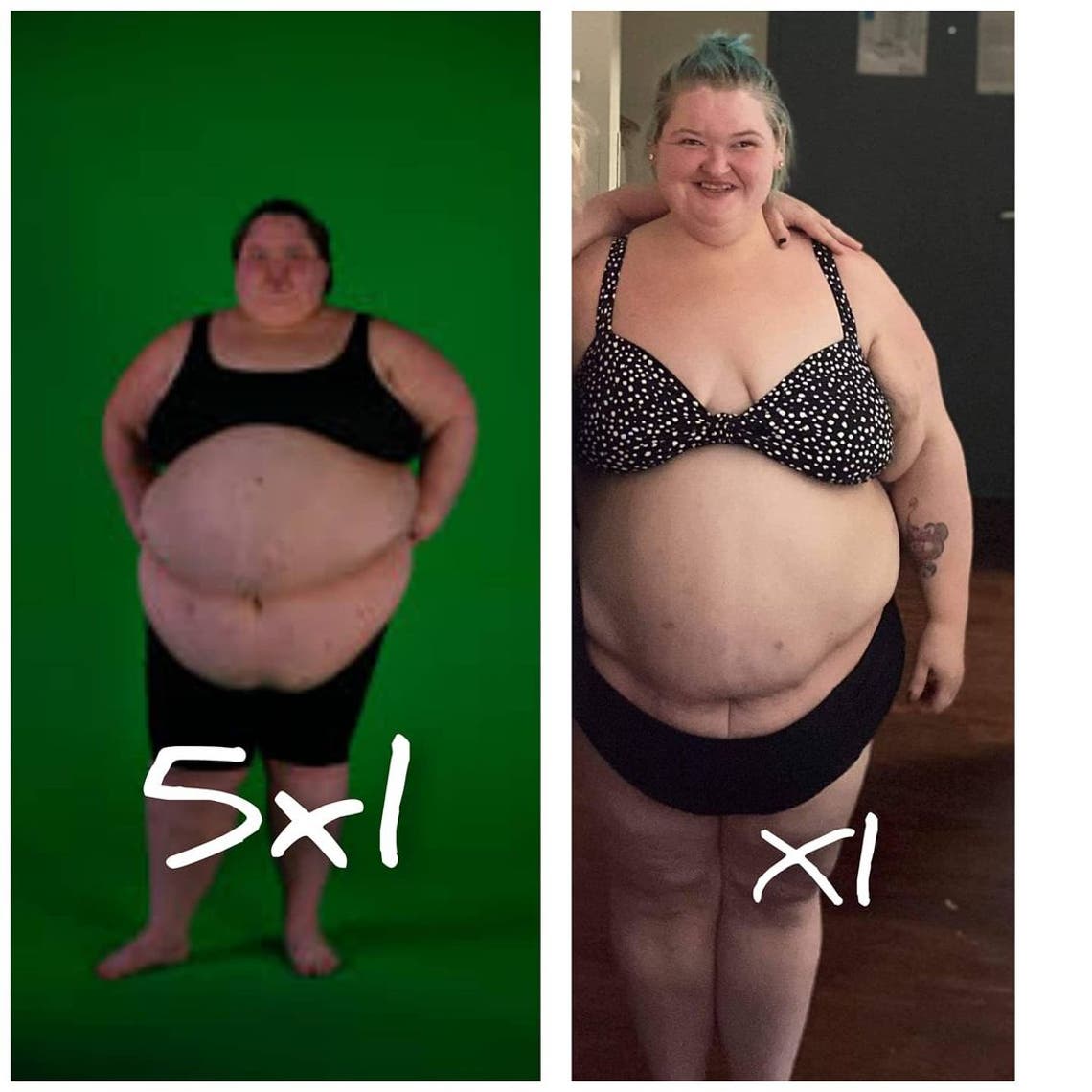 extreme weight loss before after
