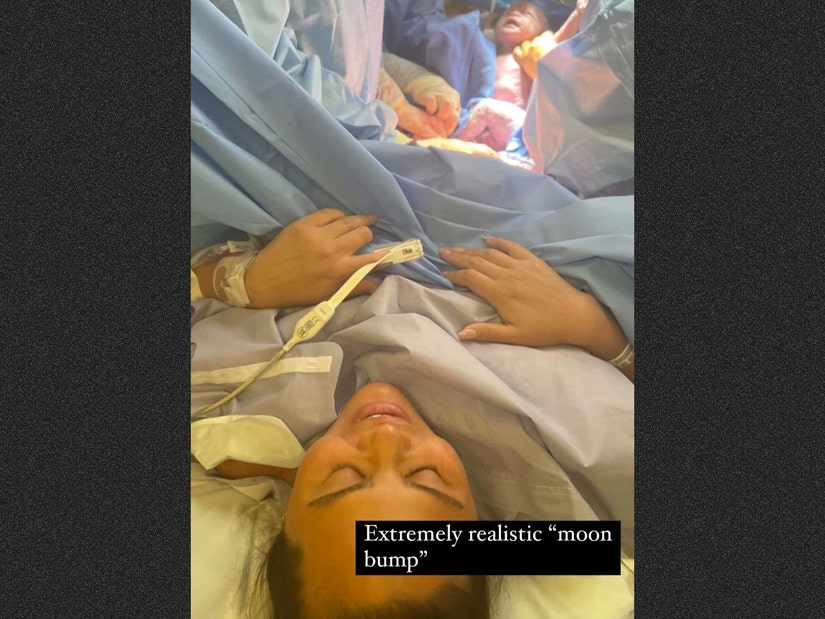 Chrissy Teigen pubblica immagini del taglio cesareo in risposta all’oltraggiosa affermazione di aver usato un surrogato