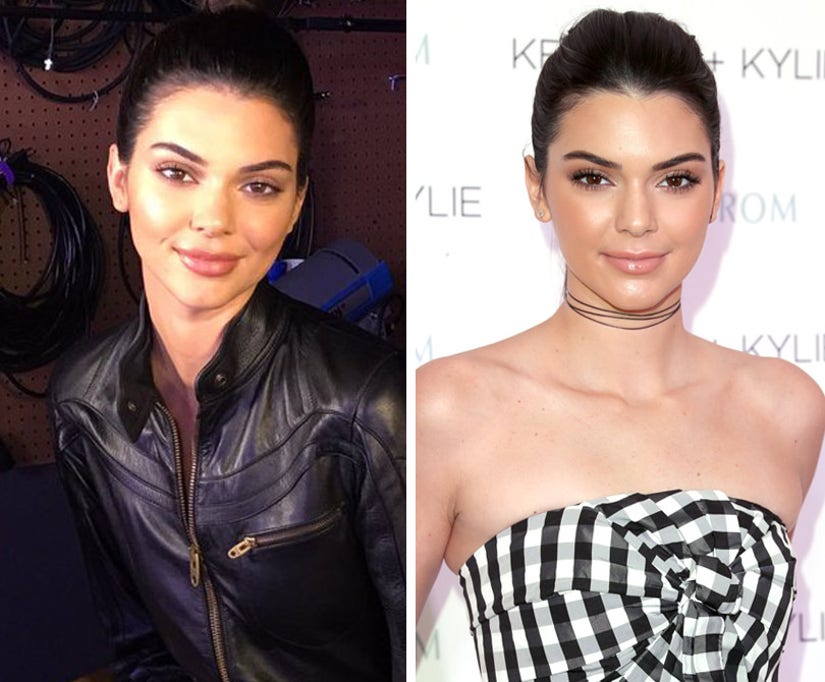 Kendall Jenner Fires Back Over Pesky 'Facial Reconstruction,' Lip
Injection Reports