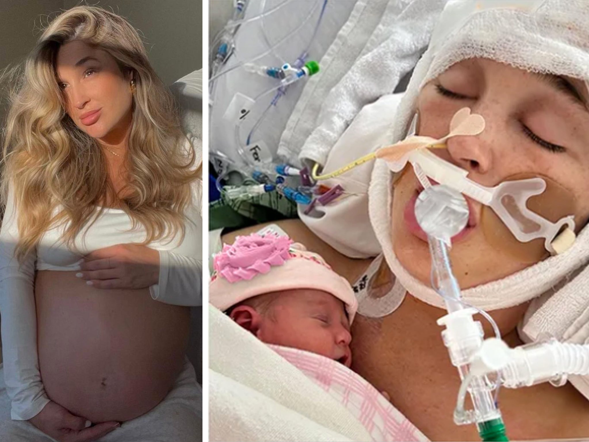 Pregnant Influencer In Medically Induced Coma After Suffering Aneurysm Week  Before Due Date