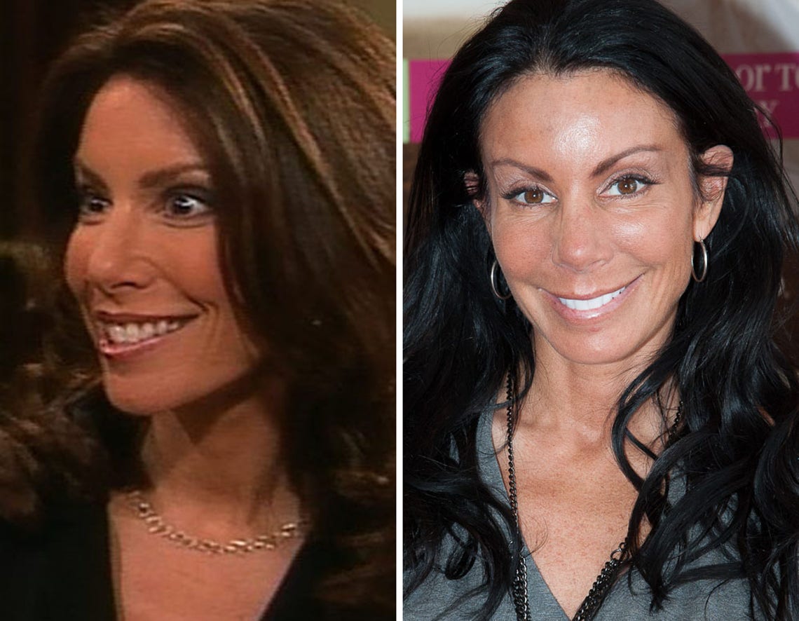 Real Housewives Cosmetic Surgery Confessions