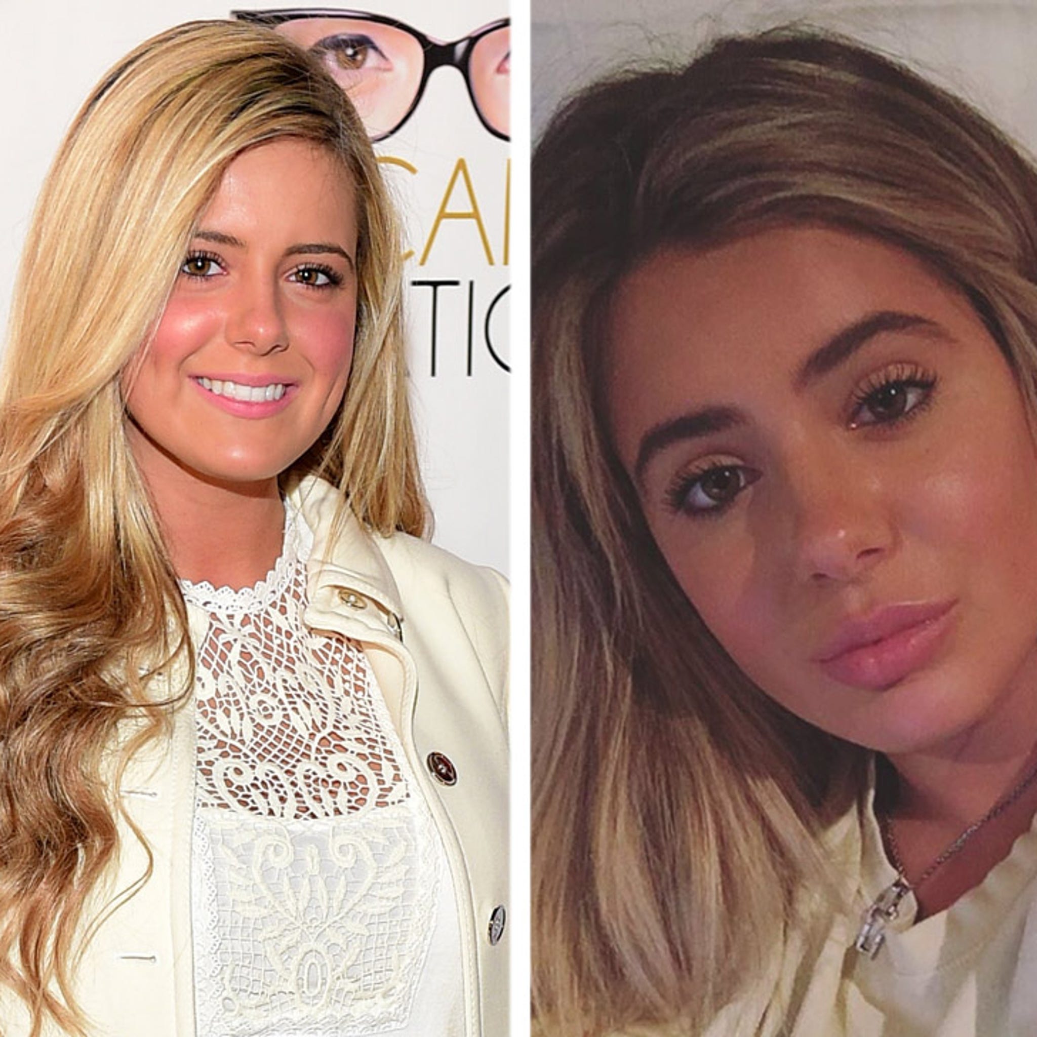 Kim Zolciak's Daughter Responds To Rumors She Had Plastic Surgery