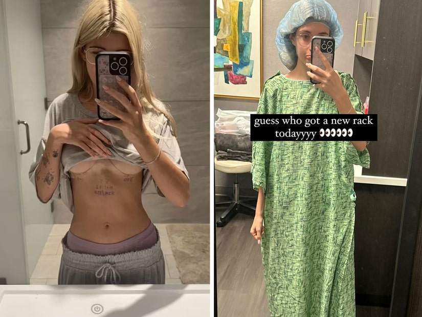 Sami Sheen, 19, Documents Boob Job After Mom Denise Richards Tried