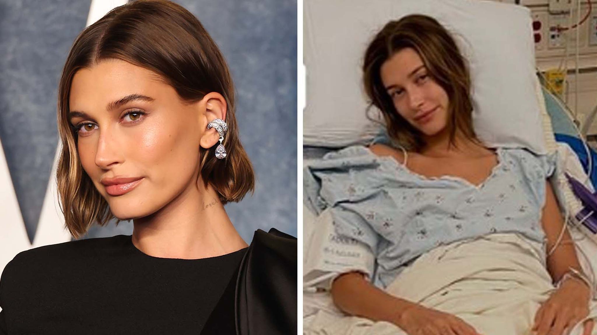 Hailey Bieber Marks One Year Since Undergoing Heart Surgery After Mini-Stroke