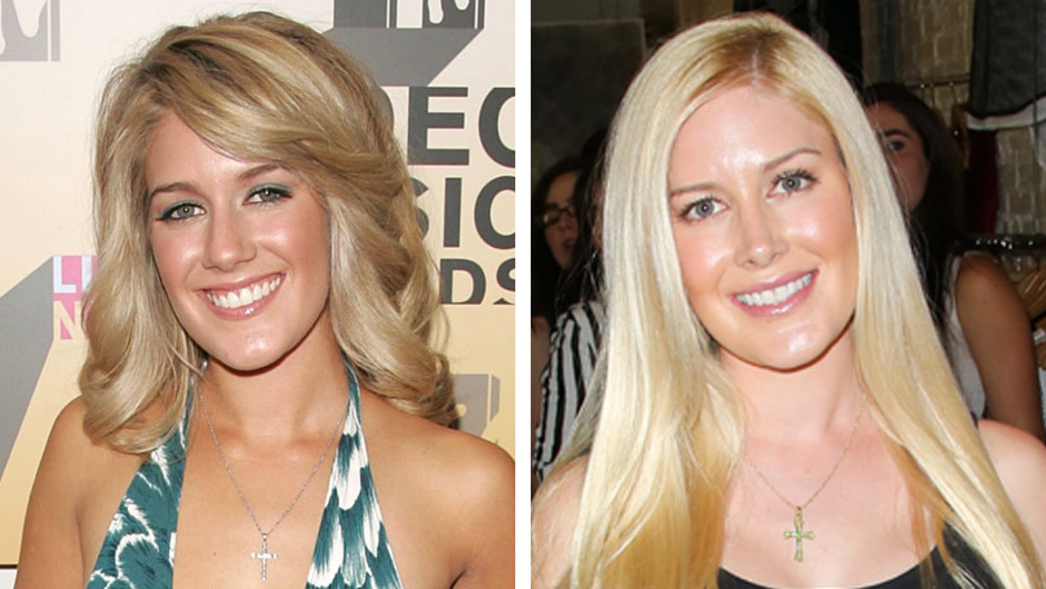 Heidi Montag Other Stars Have Had Just as Many Surgeries
