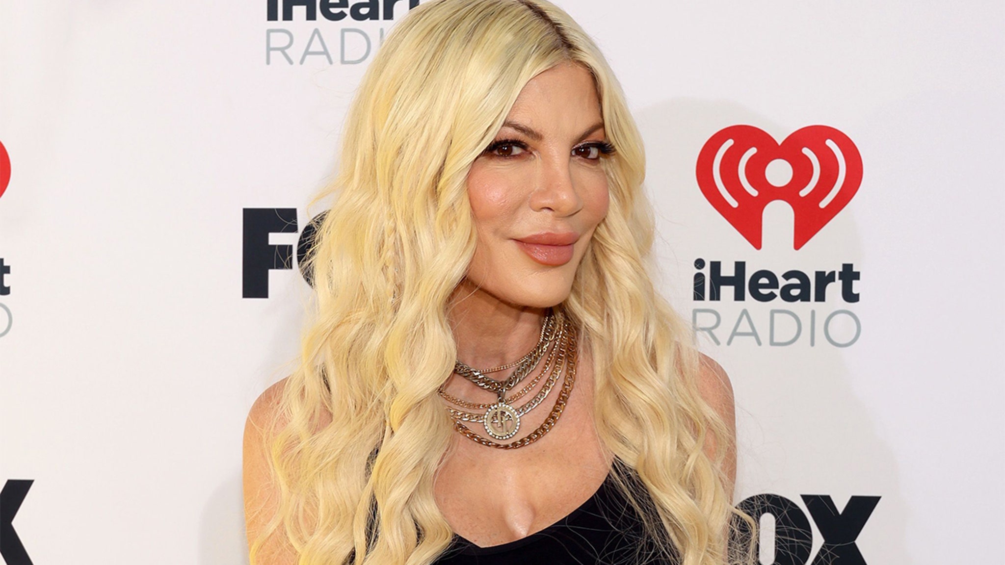 Tori Spelling Reveals She Fainted Three Days Ago Leading to Six Stitches, Possible Concussion