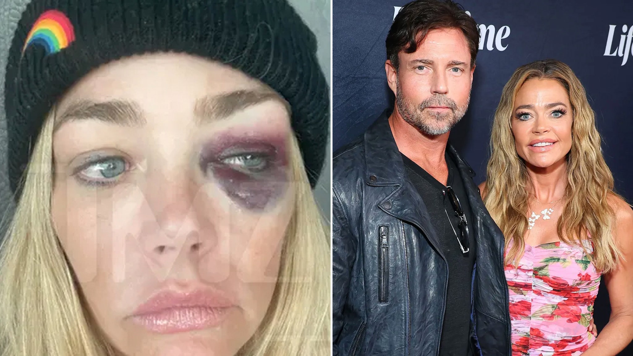 All the Alleged Abuse Denise Richards Detailed In Aaron Phypers Restraining Order Docs