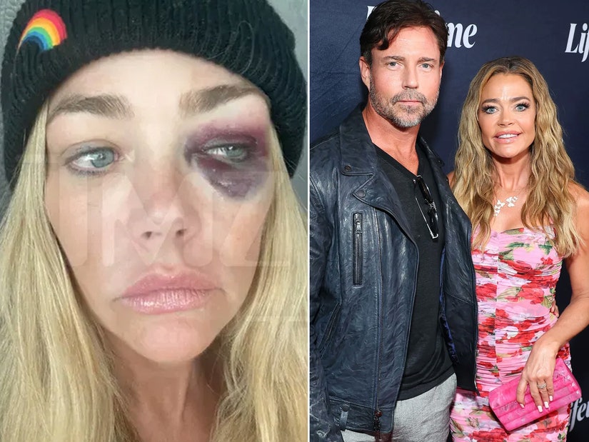 All the Alleged Abuse Denise Richards Detailed In Aaron Phypers Restraining Order Docs