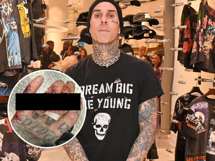 Travis Barker Reveals Shocking Hand Injury After Blink 182 Concert