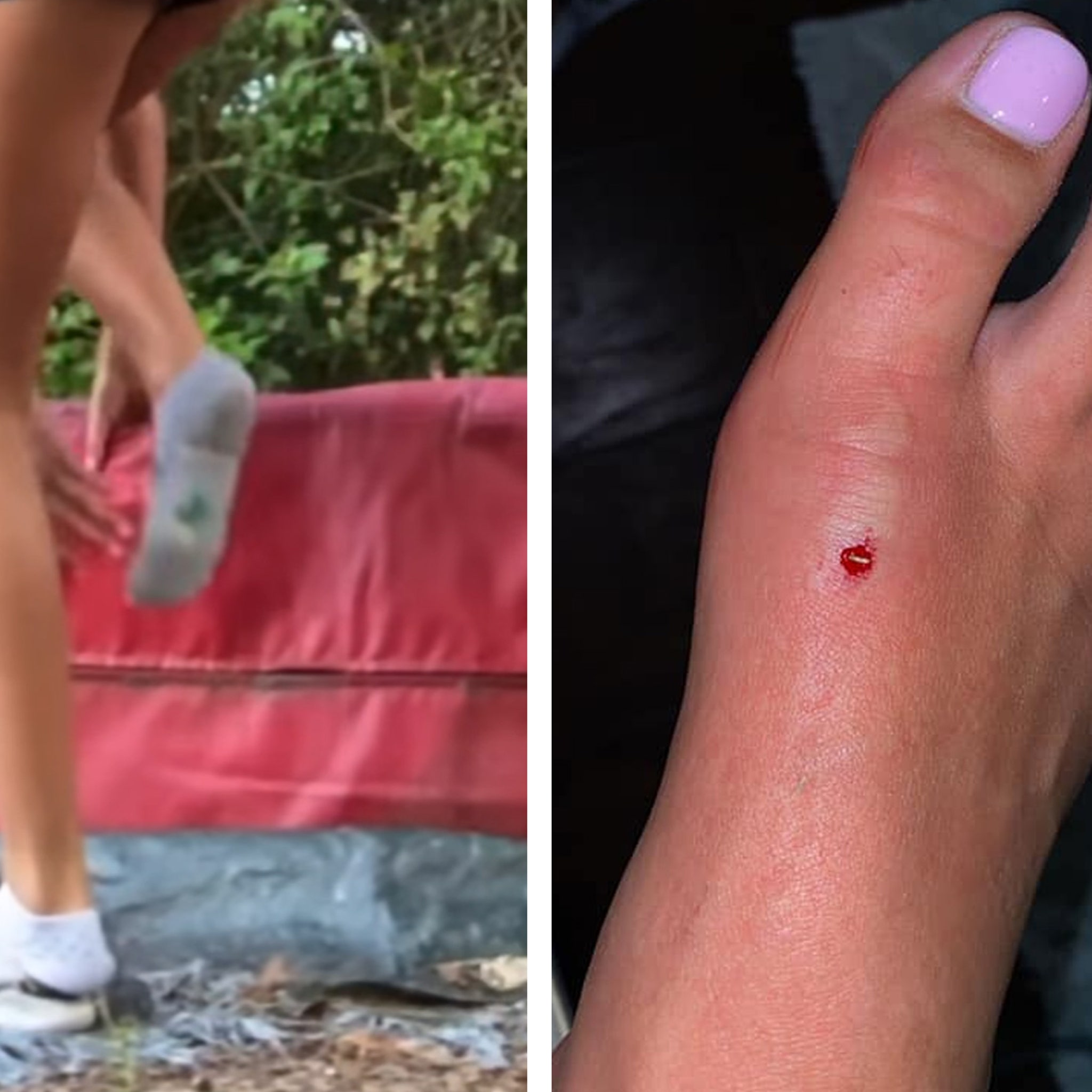 Cheerleader Films Moment Venomous Copperhead Snake Bites Her