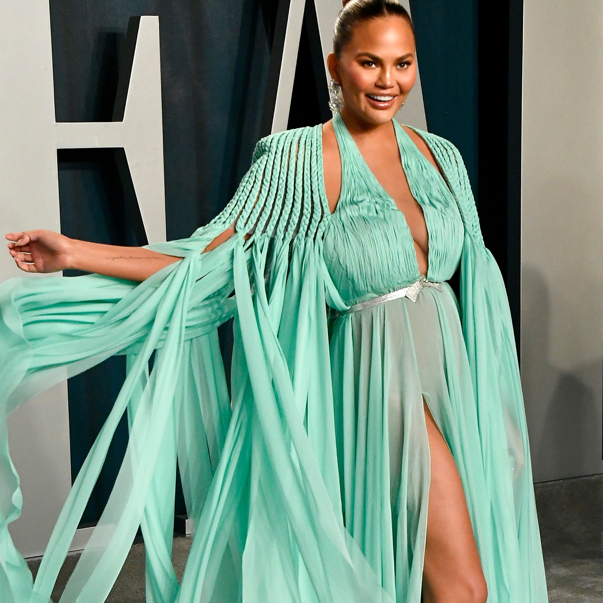 Chrissy Teigen Opens Up About Plastic Surgery for First Time