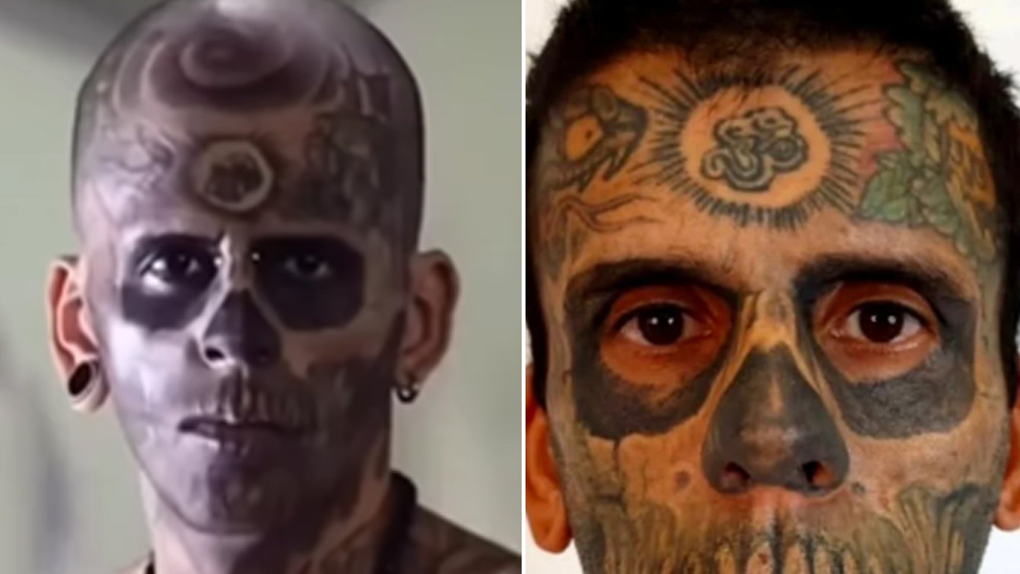 Man Covered In Tattoos Reveals Drastic Transformation After Removing Them