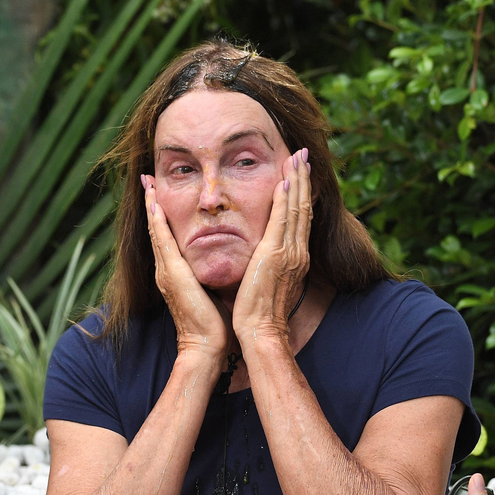 Caitlyn Jenner's Wild I'm a Celebrity...Get Me Out of Here! Experiences