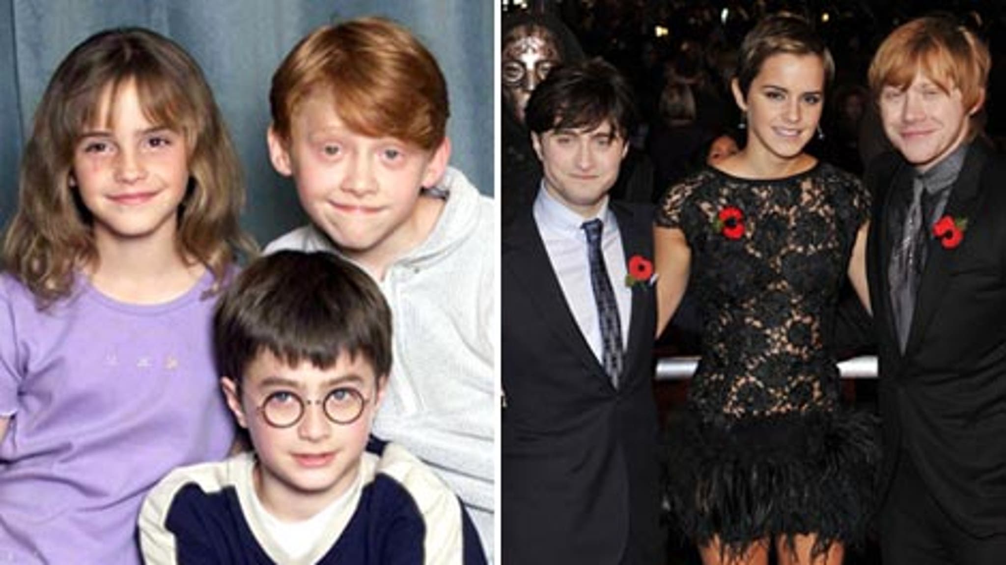Harry Potter Cast Then Now Photos Video | My XXX Hot Girl