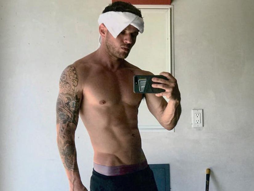 Ryan Phillippe Is Shirtless with Leg Cast and Has Us Drooling. 