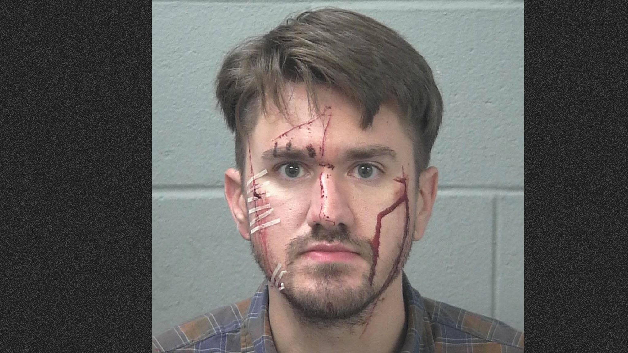 Texas Man Accused of Cutting Own Face with Razor Blade to Frame Girlfriend for Assault