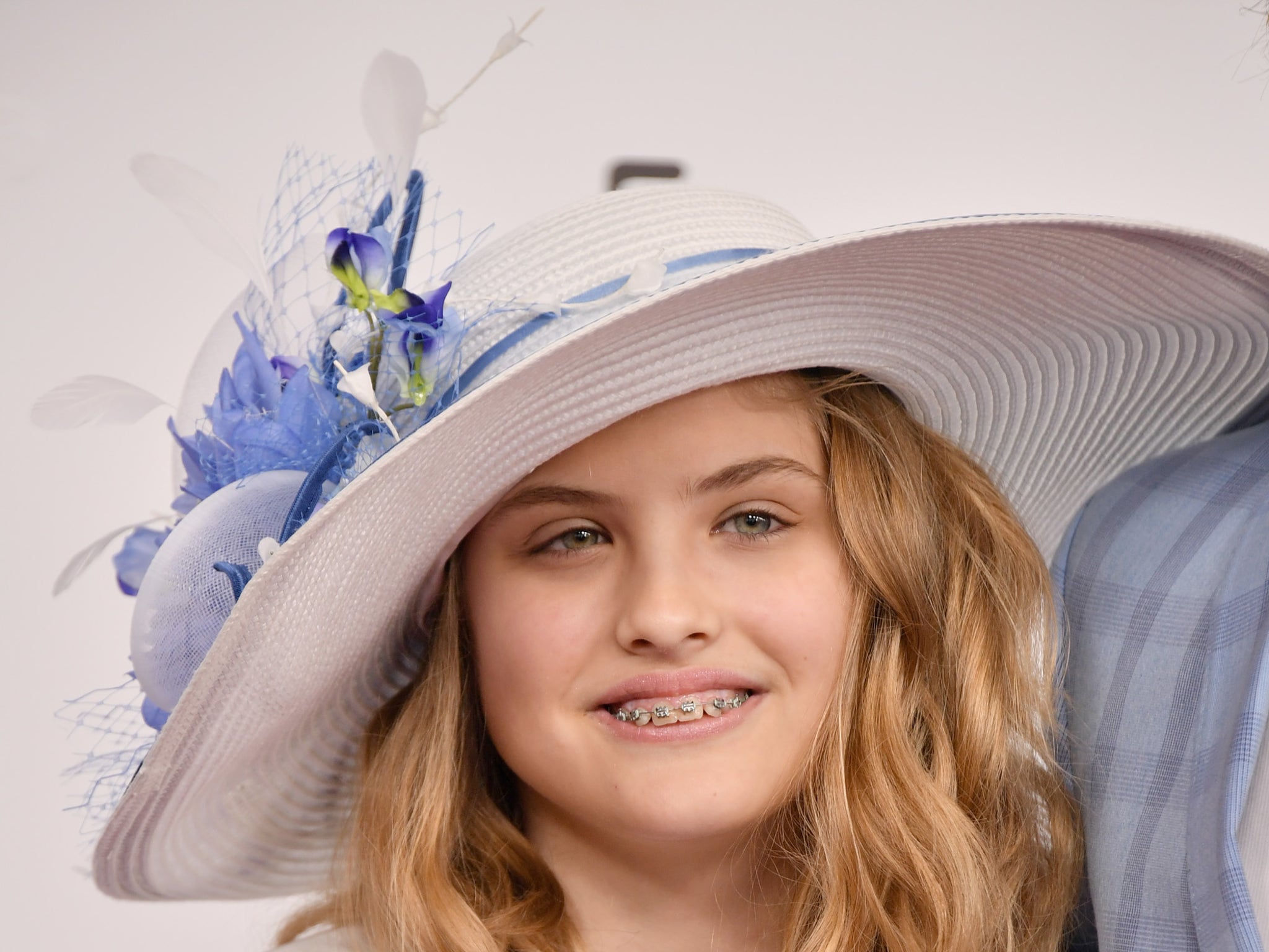 Dannielynn Birkhead Lazy Eye