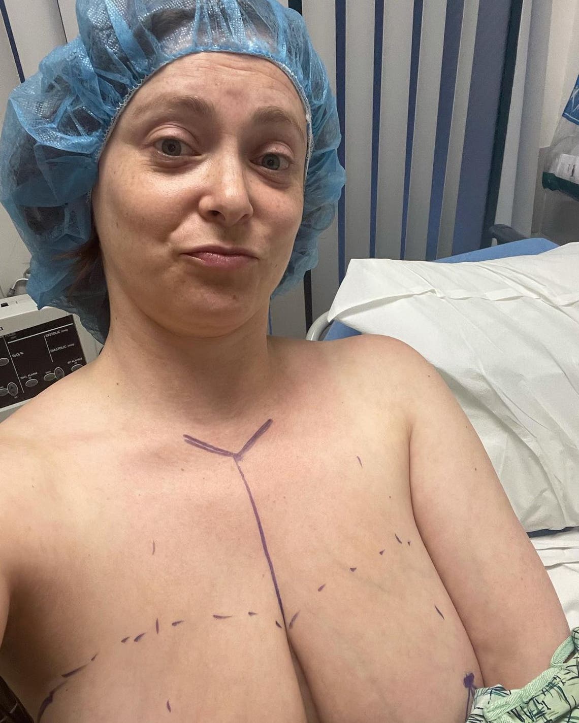 My nipples have been put on too high!': Woman, 57, says she felt like a  'freak' after bungled breast reduction to cure back pain