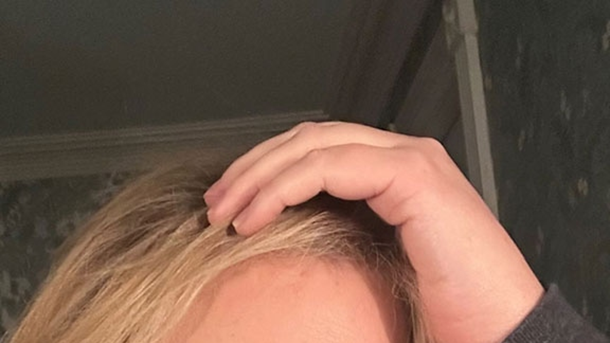 Amy Schumer Shares Transparent, 'No Filter, No Filler' Selfie