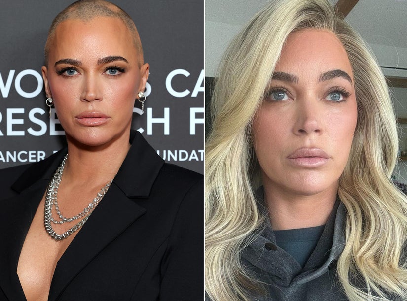 Teddi Mellencamp Details 'Day to Day' Decision to Wear Wig or Not: 'Crying Days I Tend to Pick the Wig'