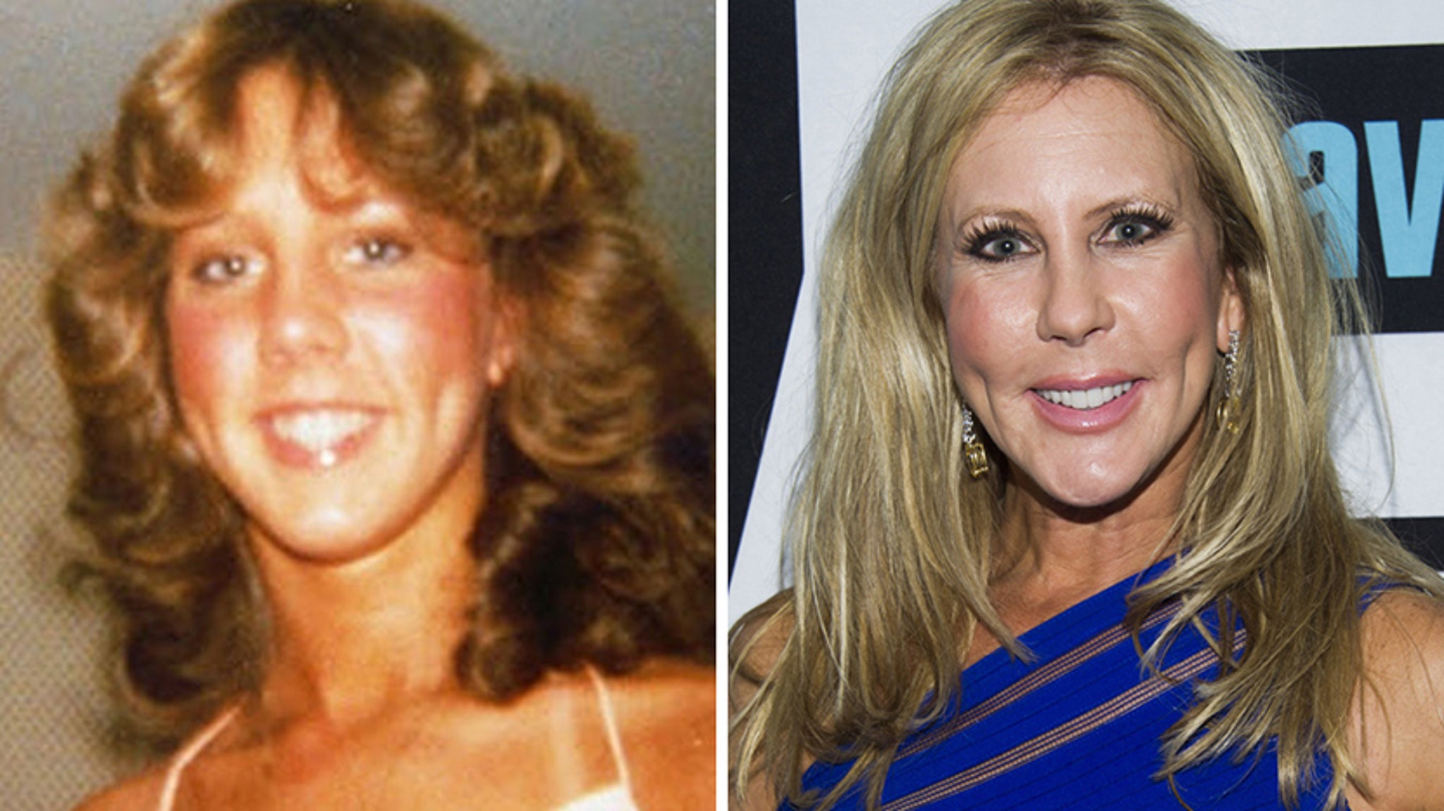 Heather altman before and after plastic surgery