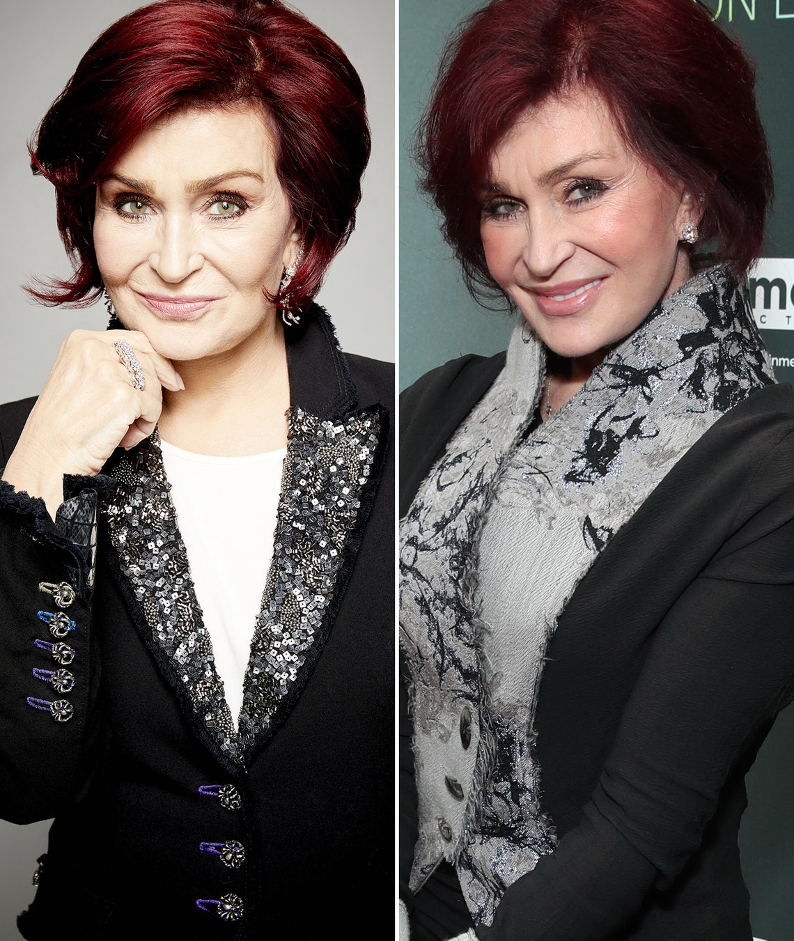In August, Sharon Osbourne got a face lift, which she debuted on the Sept. 9 season premiere of "The Talk." "It was 5 weeks today I had my operation and I had my neck done, my jowls gone," she said, adding that it was basically like her doctor pulled everything to "the top of my head and put an elastic band" there to hold it in place. "Everything was just lifted up so it looks more refreshed."