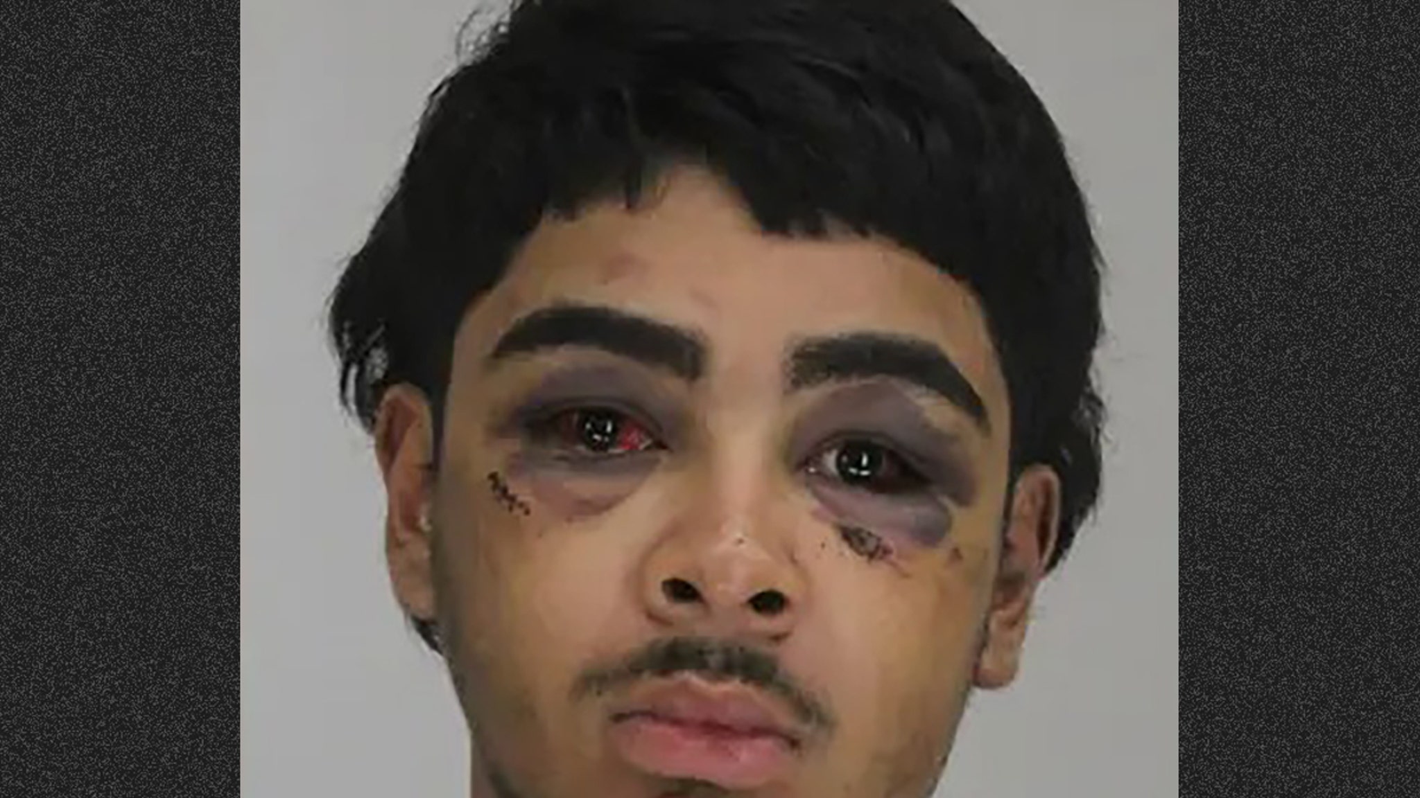 Teen Battered in Mugshot Claims Self-Defense After Shooting Death of Baby's Father at Baptism: Police